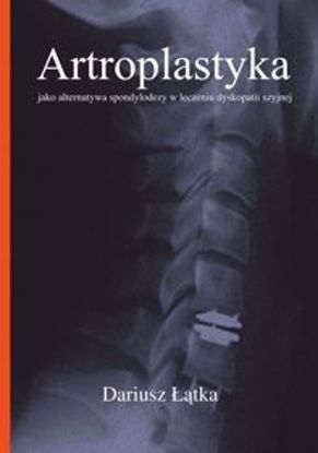 Obrazek Artroplastyka jako alternatywa spondylodezy w leczeniu dyskopatii szyjnej (STUDIA I MONOGRAFIE NR 556)