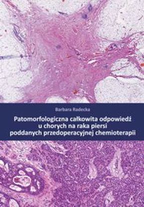 Obrazek Patomorfologiczna całkowita odpowiedź u chorych na raka piersi poddanych przedoperacyjnej chemioterapii (STUDIA I MONOGRAFIE NR 573)